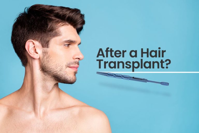 What Happens After A Hair Transplant? Beauty Travel 24 Explains The Following Procedure