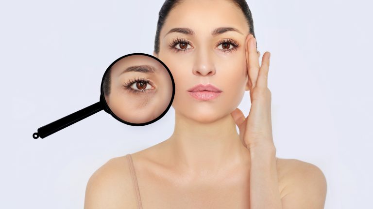 Say Goodbye To Eye Bags With Lower Blepharoplasty